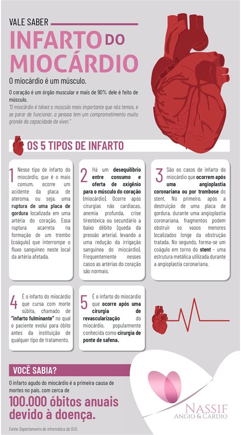 o quw fzer quanto esta fendi um infartos|Infarto agudo do miocárdio (IAM) .